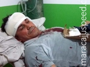 Vereador relata agressão na porta de casa: "Bateram até quebrar machado" Vereador relata agressão na porta de casa: "Bateram até quebrar machado"