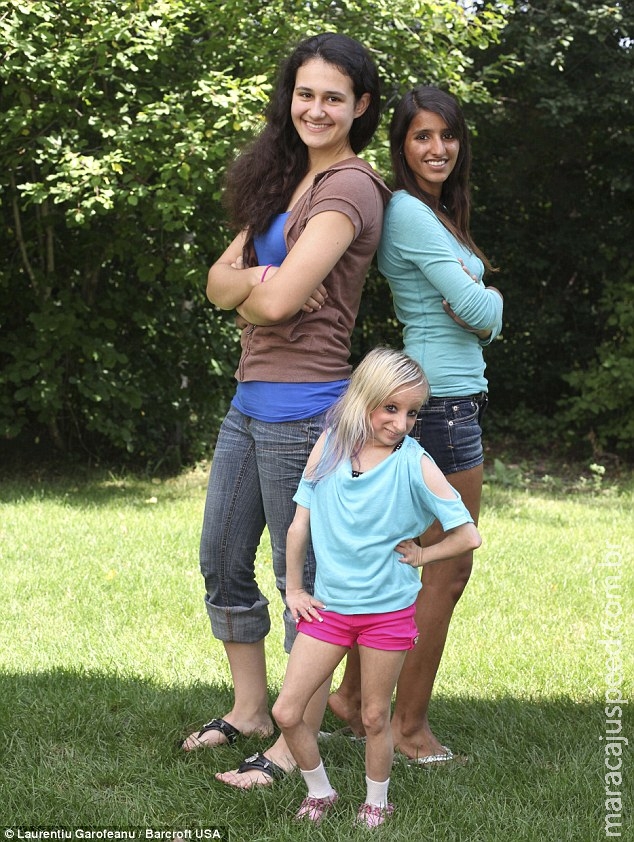 Conheça a jovem de 19 anos que mede menos de 1 metro de altura e pesa pouco mais de 12 kg 