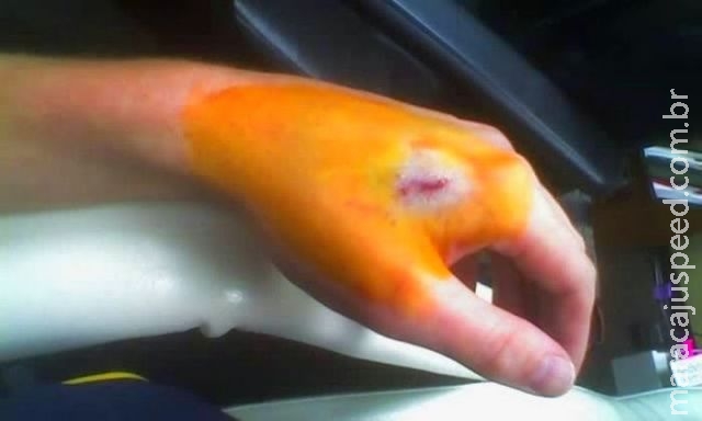 Escritório troca senhas por implante de chips nos funcionários Escritório troca senhas por implante de chips nos funcionários
