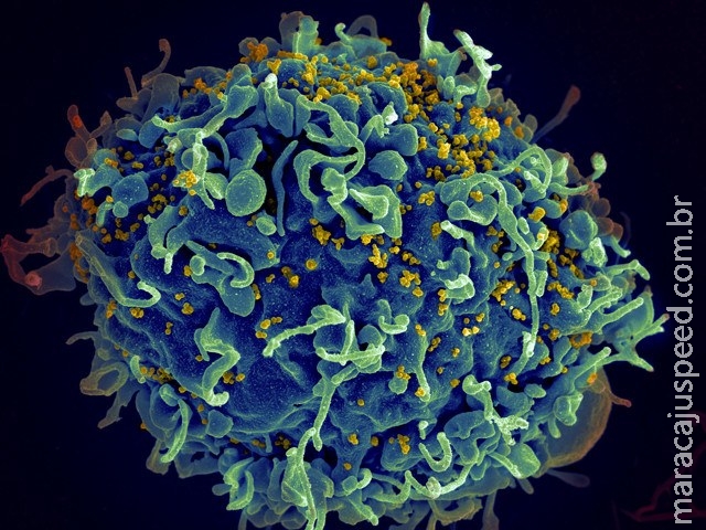 Descoberto agente anti-HIV tão poderoso que pode virar vacina Descoberto agente anti-HIV tão poderoso que pode virar vacina