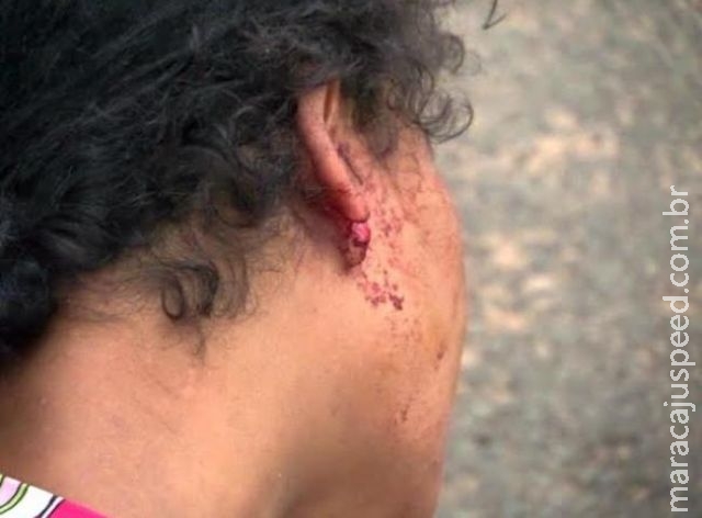Grávida tem orelha cortada durante briga com marido