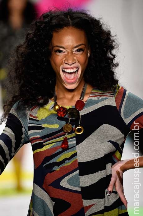 Modelo com vitiligo é destaque em passarela de Nova York Modelo com vitiligo é destaque em passarela de Nova York