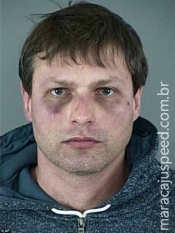 Homem é filmado socando o próprio rosto 45 vezes antes de apresentar queixas de abusos policiais Homem é filmado socando o próprio rosto 45 vezes antes de apresentar queixas de abusos policiais