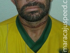 Homem é torturado e enterrado vivo e sai de cova sozinho Homem é torturado e enterrado vivo e sai de cova sozinho