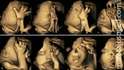 Imagens chocantes mostram diferença entre fetos de mães fumantes e não fumantes