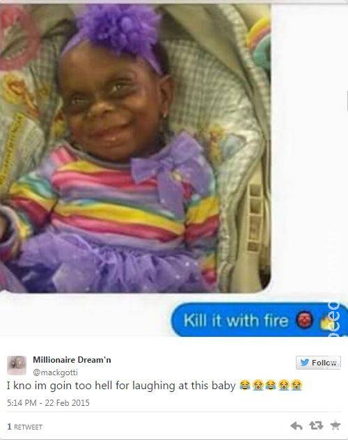 Internautas zombam de bebê com doença rara após mãe postar foto da criança em rede social Internautas zombam de bebê com doença rara após mãe postar foto da criança em rede social