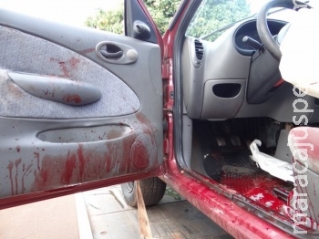 Motorista é preso após atropelar duas mulheres, fugir sem prestar socorro e balear a própria perna Motorista é preso após atropelar duas mulheres, fugir sem prestar socorro e balear a própria perna