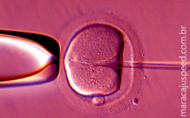  Homem pede indenização de R$ 480 mil à ex-mulher depois que descobriu que não era pai de seu filho