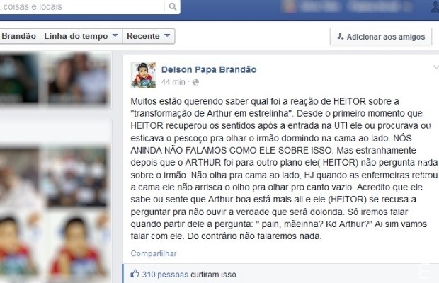 Pai diz que siamês sobrevivente ainda não perguntou do irmão que morreu Pai diz que siamês sobrevivente ainda não perguntou do irmão que morreu