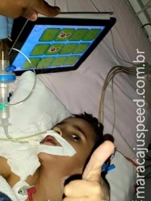Pai de siamês separado diz que filho voltou a se alimentar sem sonda Pai de siamês separado diz que filho voltou a se alimentar sem sonda