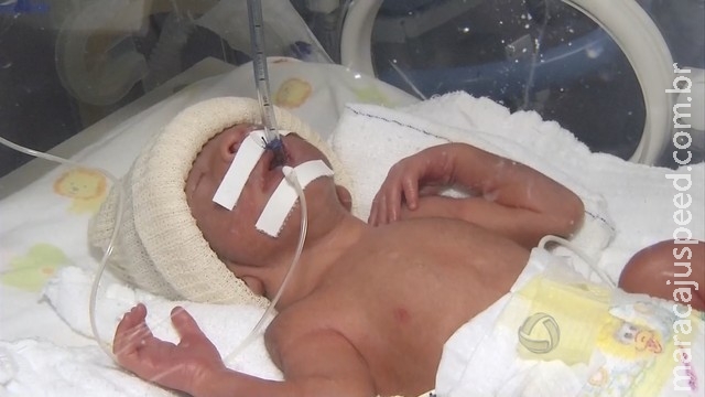Quadrigêmeos nascem prematuros e estão internados em hospital de MS