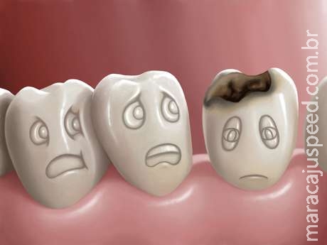 Um terço da população mundial sofre com problemas dentários Um terço da população mundial sofre com problemas dentários