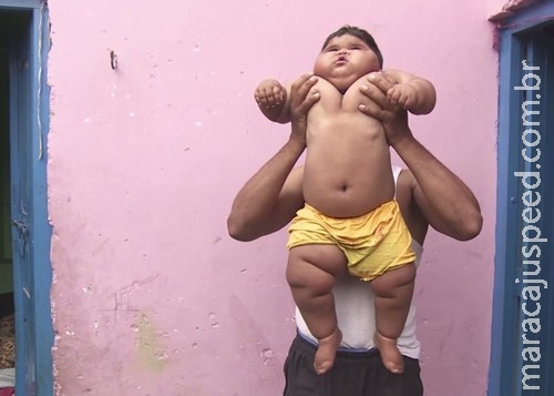 Menina de 10 meses tem peso de criança de 6 anos Menina de 10 meses tem peso de criança de 6 anos