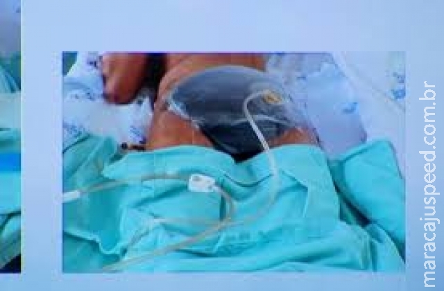 Jovem fica internada após ter bumbum dilacerado por namorado Jovem fica internada após ter bumbum dilacerado por namorado