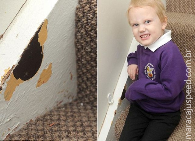 Menino com raro transtorno come tudo o que vê pela frente 