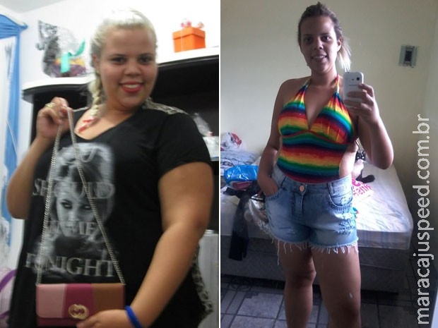 Dificuldade para encontrar roupas faz técnica de farmácia emagrecer 45 kg Dificuldade para encontrar roupas faz técnica de farmácia emagrecer 45 kg