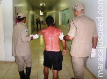 Mulher ateia fogo no marido durante discussão em MS Mulher ateia fogo no marido durante discussão em MS