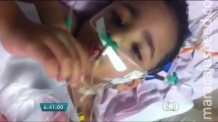 Pai posta imagem do gêmeo siamês que sobreviveu se recuperando Pai posta imagem do gêmeo siamês que sobreviveu se recuperando