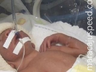 Quadrigêmeos nascem prematuros e estão internados no HU de Dourados Quadrigêmeos nascem prematuros e estão internados no HU de Dourados