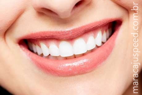 Genvivoplastia: mude sua gengiva de forma simples e sem dor Genvivoplastia: mude sua gengiva de forma simples e sem dor