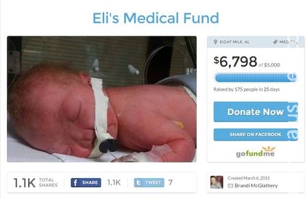 Família arrecada dinheiro para o tratamento de bebê que nasceu sem nariz  