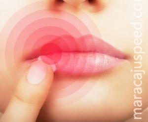 Saiba mais sobre herpes Saiba mais sobre herpes