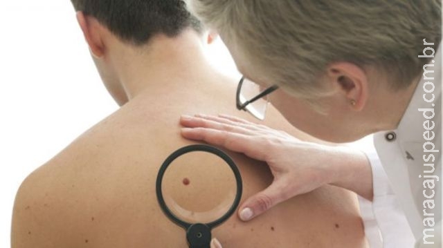 Cientistas usam vírus da herpes para curar câncer de pele Cientistas usam vírus da herpes para curar câncer de pele