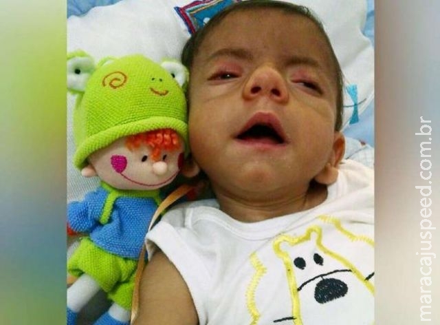 Remédio à base de maconha interrompe convulsões de bebê Remédio à base de maconha interrompe convulsões de bebê