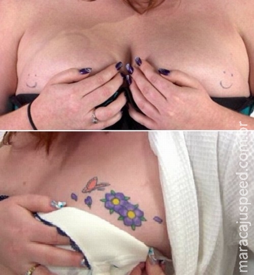 Mulher se arrepende de tatuagens de carinhas sorridentes nos seios Mulher se arrepende de tatuagens de carinhas sorridentes nos seios