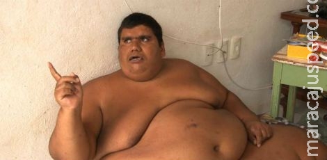 Jovem de 420 quilos receberá apoio do Hospital das Clínicas Jovem de 420 quilos receberá apoio do Hospital das Clínicas