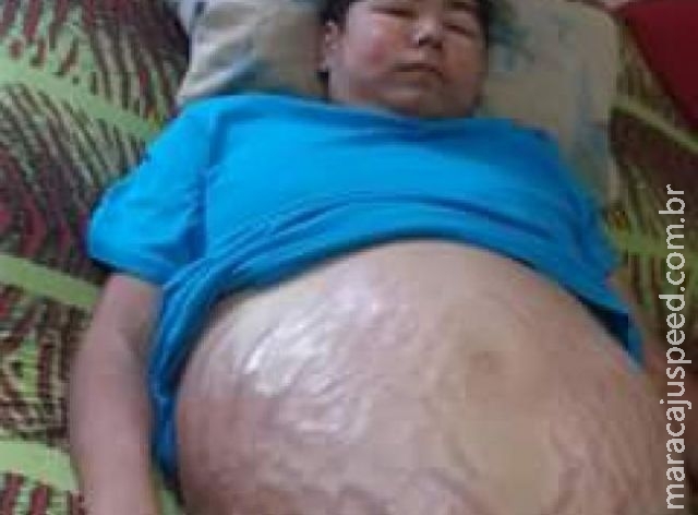 Família pede ajuda em redes sociais para ajudar filho com problema grave nos rins