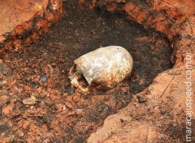 Crânio que lembra alienígena é encontrado na Rússia Crânio que lembra alienígena é encontrado na Rússia