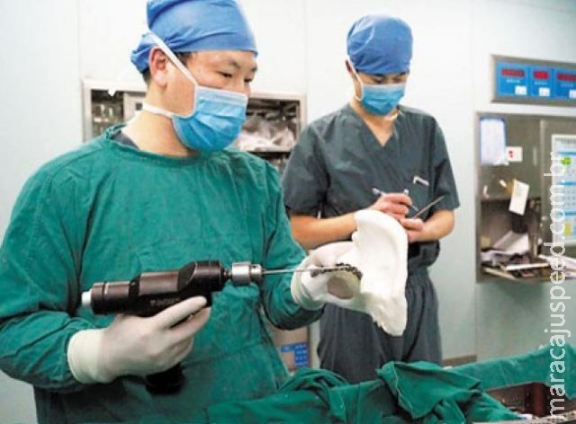 Médicos chineses implantam com sucesso osso fabricado com impressora 3D Médicos chineses implantam com sucesso osso fabricado com impressora 3D