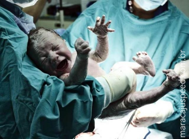 Estudantes cortam pênis de bebê em vez de cordão umbilical Estudantes cortam pênis de bebê em vez de cordão umbilical