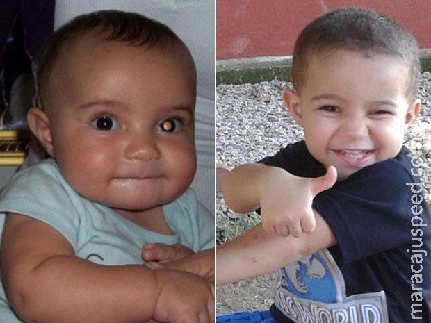 Caso de bebê que teve câncer no olho descoberto em foto alerta outros pais Caso de bebê que teve câncer no olho descoberto em foto alerta outros pais