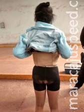 Mulher levava pasta base de cocaína dentro de cinta modeladora Mulher levava pasta base de cocaína dentro de cinta modeladora