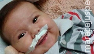 Bebê morre enquanto esperava transplante de intestino Bebê morre enquanto esperava transplante de intestino