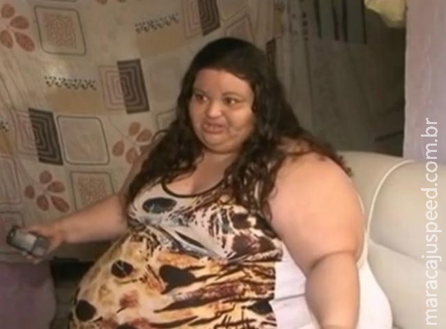 Mulher de 240 kg precisa perder 30 kg para fazer cirurgia bariátrica Mulher de 240 kg precisa perder 30 kg para fazer cirurgia bariátrica