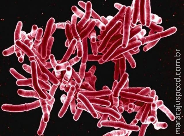Vacina em teste é mais eficaz contra tuberculose do que atual imunização Vacina em teste é mais eficaz contra tuberculose do que atual imunização
