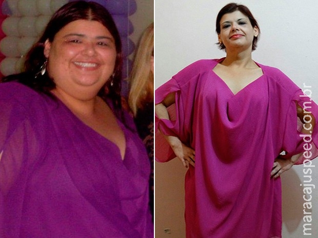 "Tinha medo de não passar na catraca", diz mulher que perdeu 94 kg "Tinha medo de não passar na catraca", diz mulher que perdeu 94 kg