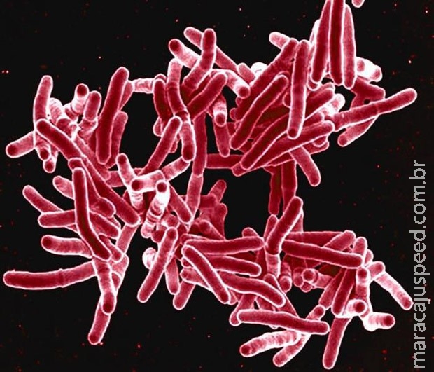 Tuberculose rivaliza com Aids em número de mortes, alerta OMS