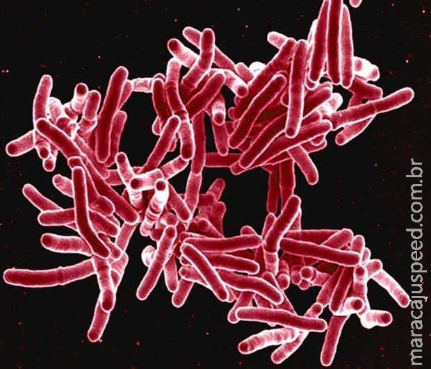 Tuberculose rivaliza com Aids em número de mortes, alerta OMS Tuberculose rivaliza com Aids em número de mortes, alerta OMS