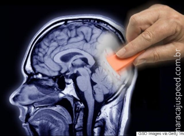 Seis sinais de que você precisa consultar um profissional de saúde mental Seis sinais de que você precisa consultar um profissional de saúde mental