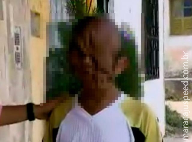 Homem tem rosto desfigurado após erro médico e desabafa: "Me chamam de monstro" Homem tem rosto desfigurado após erro médico e desabafa: "Me chamam de monstro"