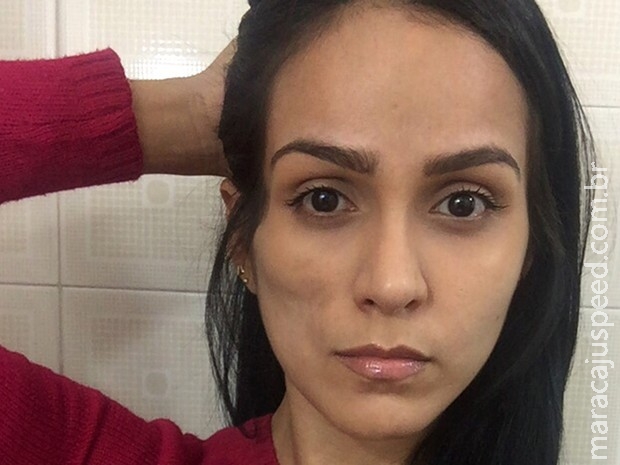 Síndrome rara que afeta ex-Miss Bumbum não tem cura, diz médico Síndrome rara que afeta ex-Miss Bumbum não tem cura, diz médico