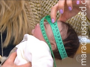 Saúde investiga morte de três bebês com microcefalia Saúde investiga morte de três bebês com microcefalia