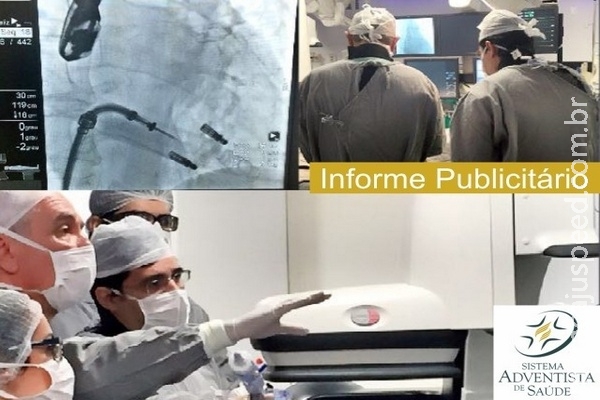 Hemodinâmica do Hospital Adventista realiza procedimento cardíaco inédito Hemodinâmica do Hospital Adventista realiza procedimento cardíaco inédito