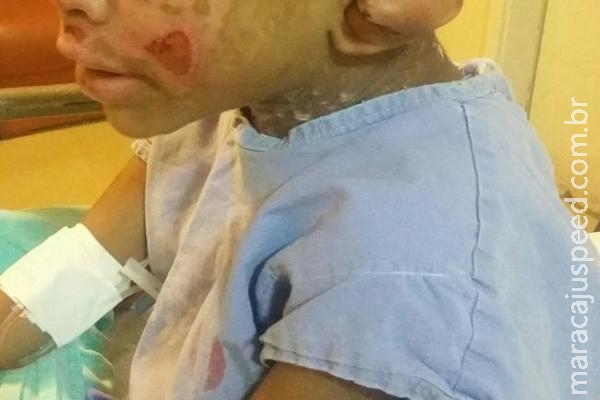 Tios torturam criança de 4 anos em Campo Grande e culpam "vozes do diabo"