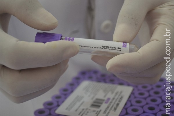Exames de dengue, zika e chikungunya vão de R$ 40 a R$ 2,1 mil na Capital Exames de dengue, zika e chikungunya vão de R$ 40 a R$ 2,1 mil na Capital