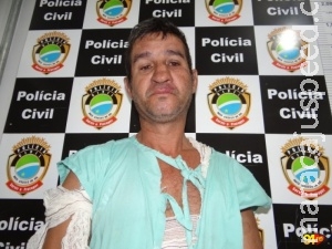 Morre homem de 56 anos queimado pelo amigo ao "chamar Lúcifer”